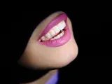 Smile makeover with veneers at Dentelli Split – cosmetic dentist in Split creating bright, natural-looking smiles