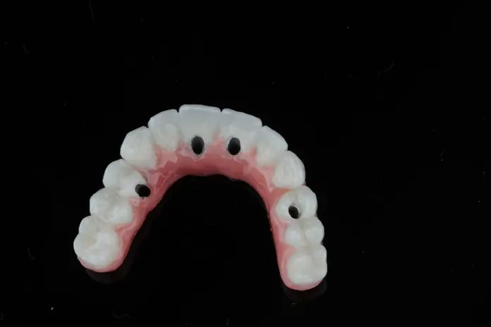 Top view of a full-arch All-on-4 dental implants