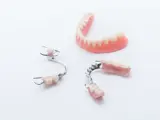 Removable partial dentures to compare with dental implants all on 4 