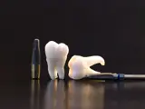Dental implants and All-on-4 at Dentelli Split – leading implant dentist in Split for full-arch tooth replacement solutions