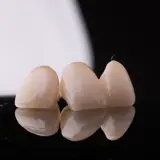 Dental crowns and bridges at Dentelli Split – trusted dentists in Split offering restorative treatments for damaged or missing teeth